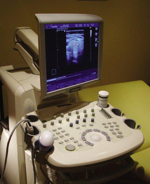 Használt SonoAce X8 ultrahang készülék pajzsmirigy vizsgálat közben Használt SonoAce X8 ultrahang készülék pajzsmirigy vizsgálat közben