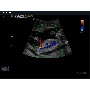 Magzat Color Doppler képe - MySono U6